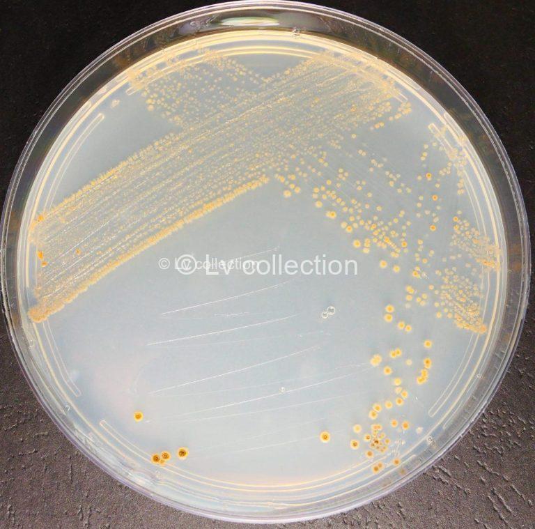 Lv2274 isp5 scaled e1757934928293