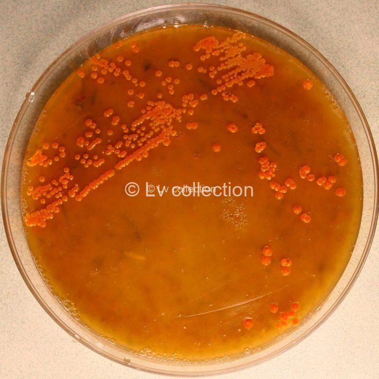 Lv2274 om scaled e1757934905252